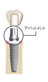 生体モニター