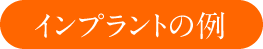 インプラントの例